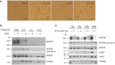 The Role of the Insulin-Like Growth Factor 1 Pathway in Immune Tumor Microenvironment and Its Clinical Ramifications in Gynecologic Malignancies